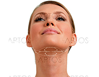 Aptos Light Lift – методы для лифтинга и моделирования лица и тела